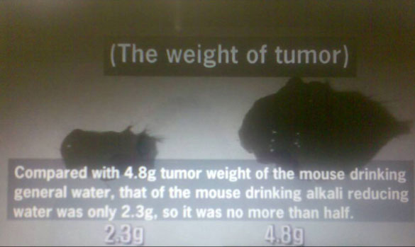 tumor